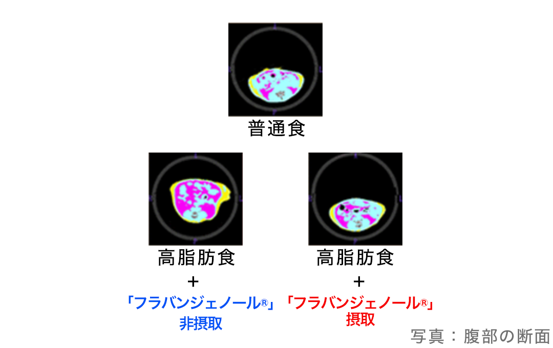 抗肥満作用、腹部の断面図