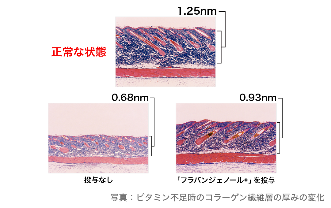 ビタミン不足時のコラーゲン繊維層の厚みの変化